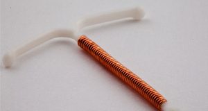 Global Intrauterine Devices Market 2017